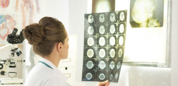 8 myths about Traumatic Brain Injury