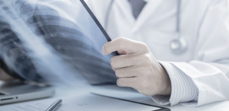 Cycling accident case study: £126,000 spinal injury compensation